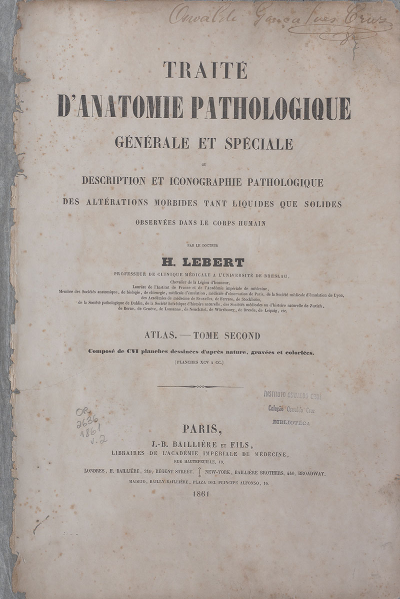 Imagem da obra Traité d&#039;anatomie pathologiquegénérale et spéciale ou description et iconographie pathologique des altérations morbides tant liquides que solides observées dans le corps humain 